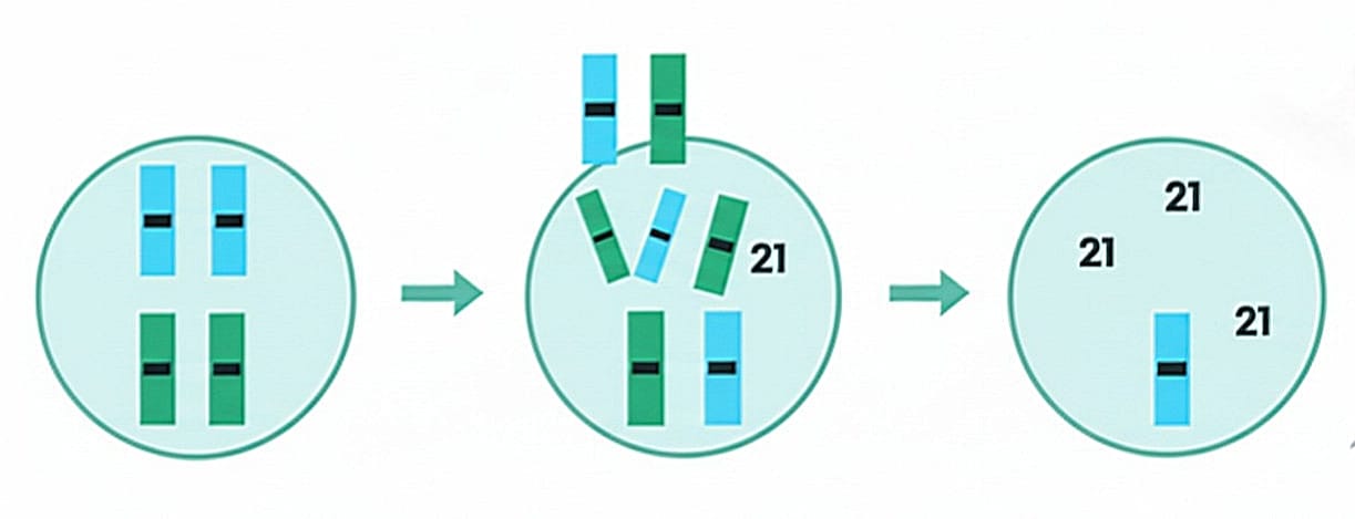 Trisomy 21 Non-Disjunction Visualization